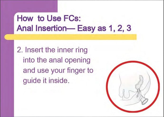 Anal_How_To_Insert
